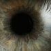 Adalimumab aids in control of noninfectious uveitis