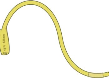 Added tension to transcervical catheters does not expedite delivery