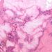 ACP releases clinical practice guidelines for acute gout