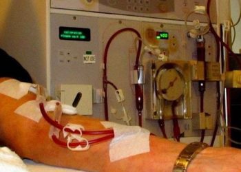 Fish oil and aspirin did not reduce arteriovenous fistula failure: The FAVOURED trail