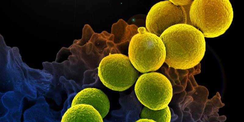 MRSA PD