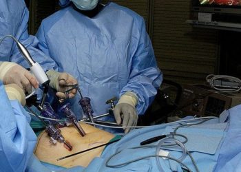 High recurrence of gastroesophageal reflux disease in patients treated with laparoscopic antireflux surgery