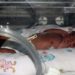 Poverty, preterm birth demonstrate additive effect on cognition
