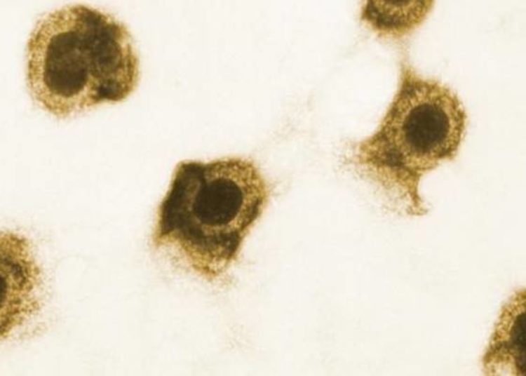 Postnatal cytolomegalovirus infection not linked to impaired motor development