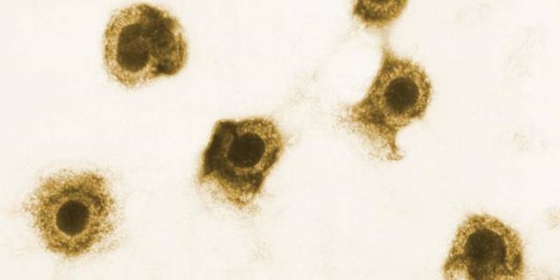 CMV cytomegalovirus PD