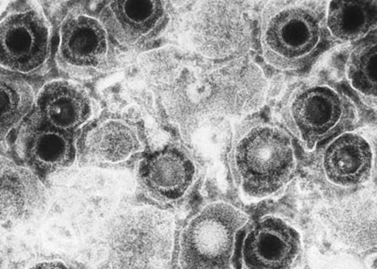 Herpes simplex virus infection uncommon in infants undergoing meningitis evaluation