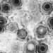 Herpes simplex virus infection uncommon in infants undergoing meningitis evaluation
