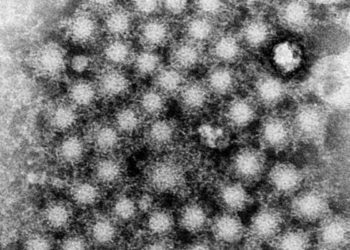 Screening insufficient for newborns exposed to hepatitis C virus