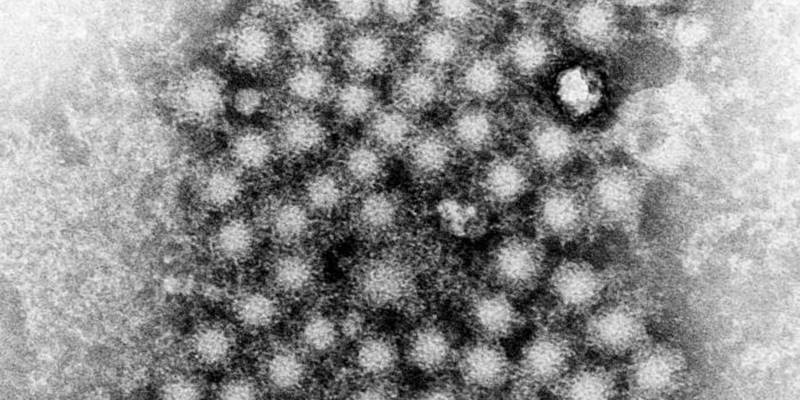 hepatitis PD