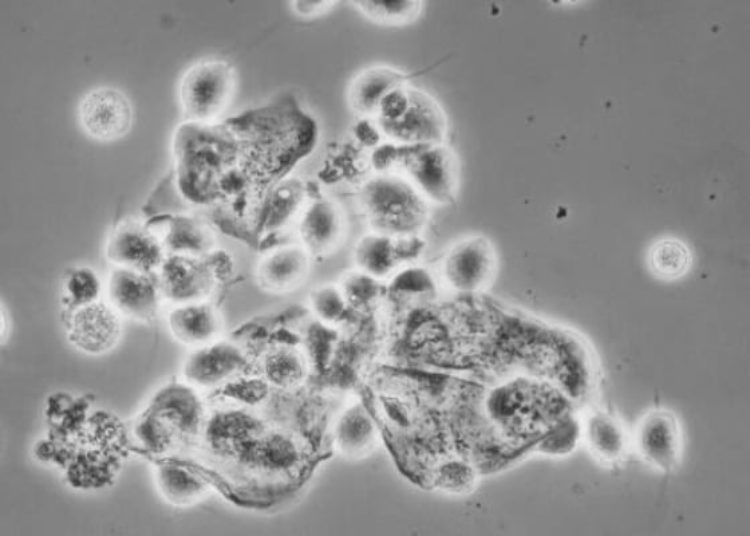 Quick Take: Single-dose versus 7-day-dose metronidazole (Flagyl) for the treatment of trichomoniasis in women: an open-label, randomized controlled trial