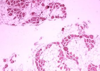 Gene therapy targets Duchenne muscular dystrophy in new trial [PreClinical]