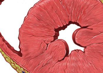 Quick Take: Association of African Ancestry with Electrocardiographic Voltage and Concentric Left Ventricular Hypertrophy: The Dallas Heart Study