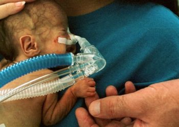 Quick Take: Analgesic efficacy and safety of morphine in the Procedural Pain in Premature Infants (Poppi) study: randomised placebo-controlled trial