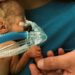 Quick Take: Analgesic efficacy and safety of morphine in the Procedural Pain in Premature Infants (Poppi) study: randomised placebo-controlled trial