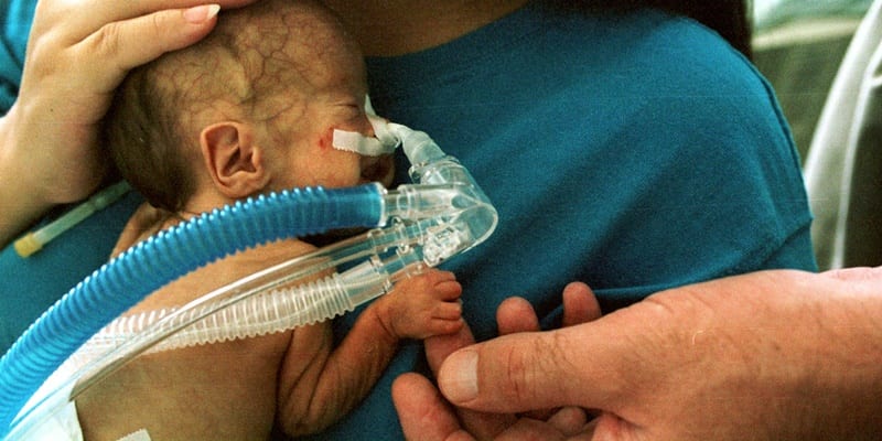 nicu