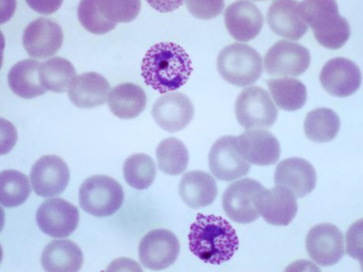 The Detective Trial Tafenoquine Reduces Risk Of Plasmodium Vivax Relapse 2 Minute Medicine