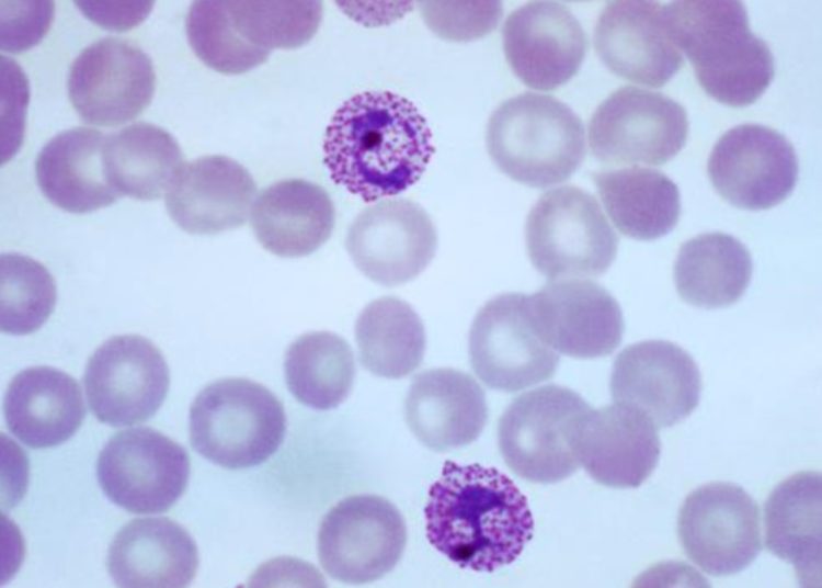 The DETECTIVE trial: tafenoquine reduces risk of Plasmodium vivax relapse