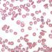 The REACH trial: hydroxyurea safe and effective for sickle cell anemia in African children