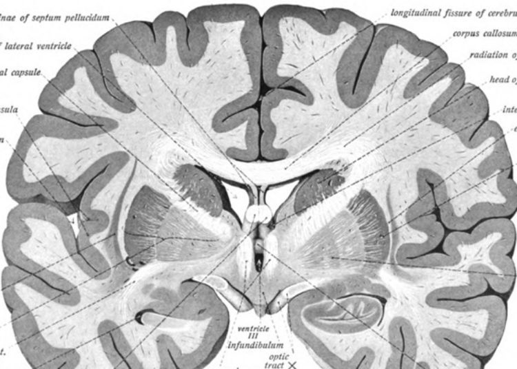 Quick Take: Association of a Schizophrenia-Risk Nonsynonymous Variant With Putamen Volume in Adolescents A Voxelwise and Genome-Wide Association Study