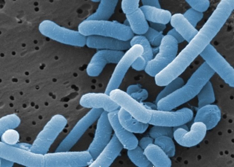 Quick Take: Association of maternal probiotic supplementation with human milk oligosaccharide composition