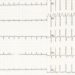Rivaroxaban likely reduces risk of recurrent stroke in specific subgroup of patients with embolic stroke of undetermined source