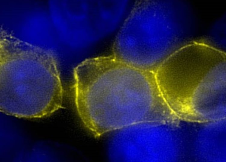 In utero administration of ivacaftor averts multiorgan disease in ferret model of cystic fibrosis [PreClinical]