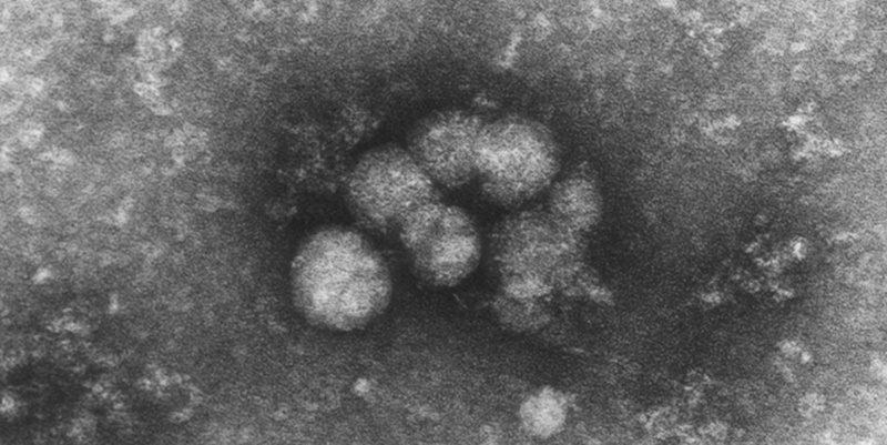 HCV_particles