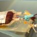 Ticagrelor reversal agent provides immediate and sustained effect
