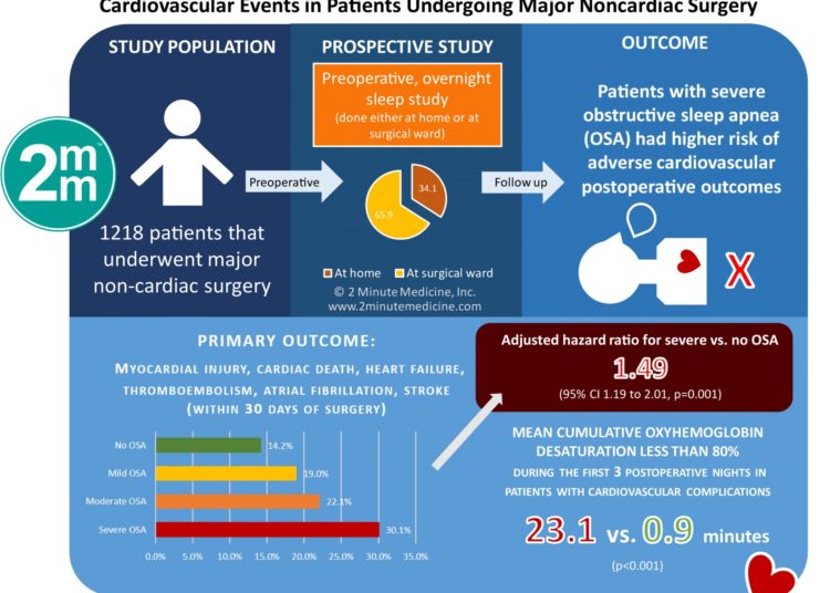 #VisualAbstract: Association of Unrecognized Obstructive Sleep Apnea With Postoperative Cardiovascular Events in Patients Undergoing Major Noncardiac Surgery