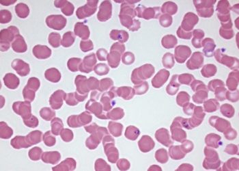 Quick Take: Short-course primaquine for the radical cure of Plasmodium vivax malaria