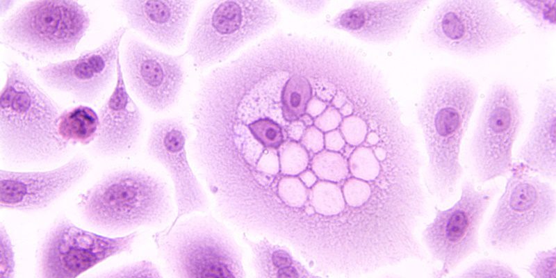 natural treatment for papilloma