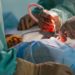 Quick Take: Intravenous patient-controlled analgesia versus thoracic epidural analgesia after open liver surgery