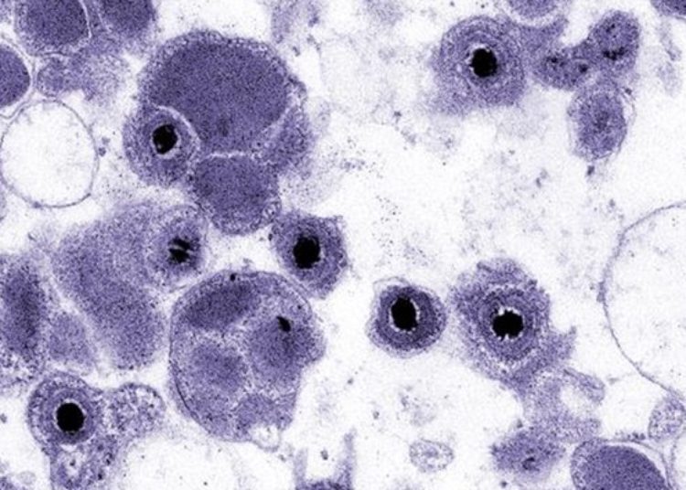 Maribavir safety and efficacy for cytomegalovirus infections among transplant recipients