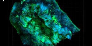 2 Minute Medicine Rewind February 2, 2026