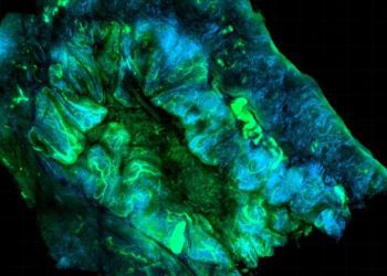 Assessment of Combined Nivolumab and Bevacizumab in Relapsed Ovarian Cancer: A Phase 2 Clinical Trial