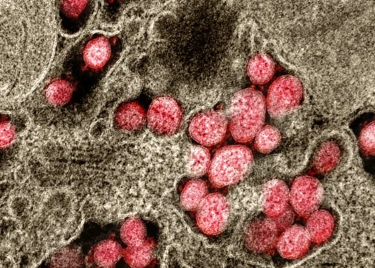 Initial data on the viability of SARS-CoV-2 in aerosol and on surfaces