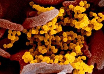 Radiological findings of COVID-19 pneumonia in Wuhan, China