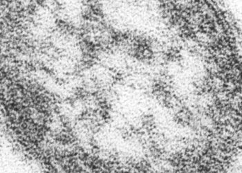 Epidemiologic features of the 2018-2019 measles outbreak in New York City