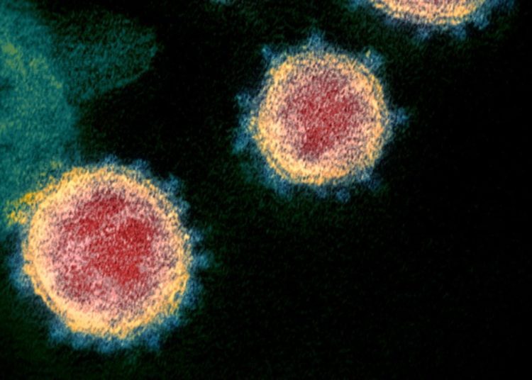 SARS-CoV-2 detected on various surroundings of asymptomatic COVID-19 positive infant