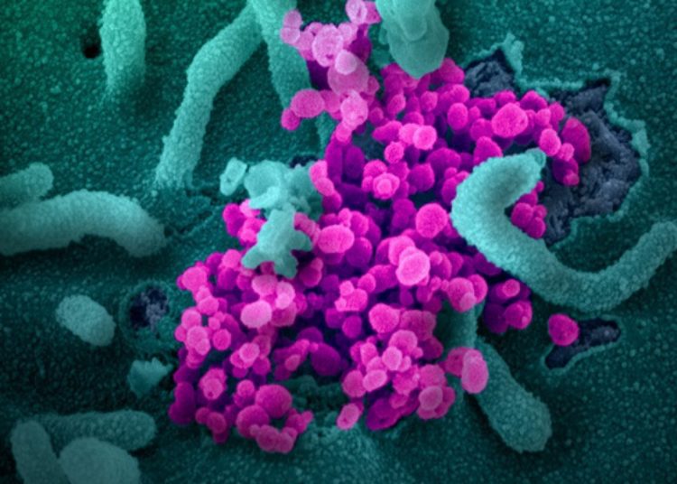 Critically ill COVID-19 patients may benefit from convalescent plasma therapy