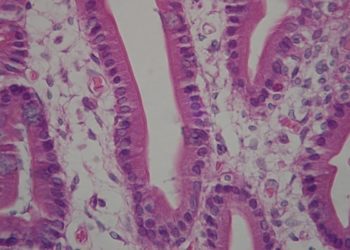 Duodenal microbiota linked with environmental enteric dysfunction