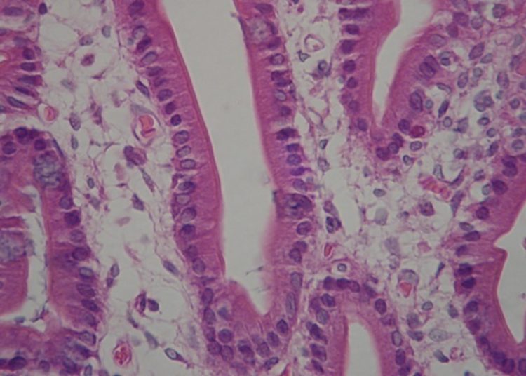 Duodenal microbiota linked with environmental enteric dysfunction