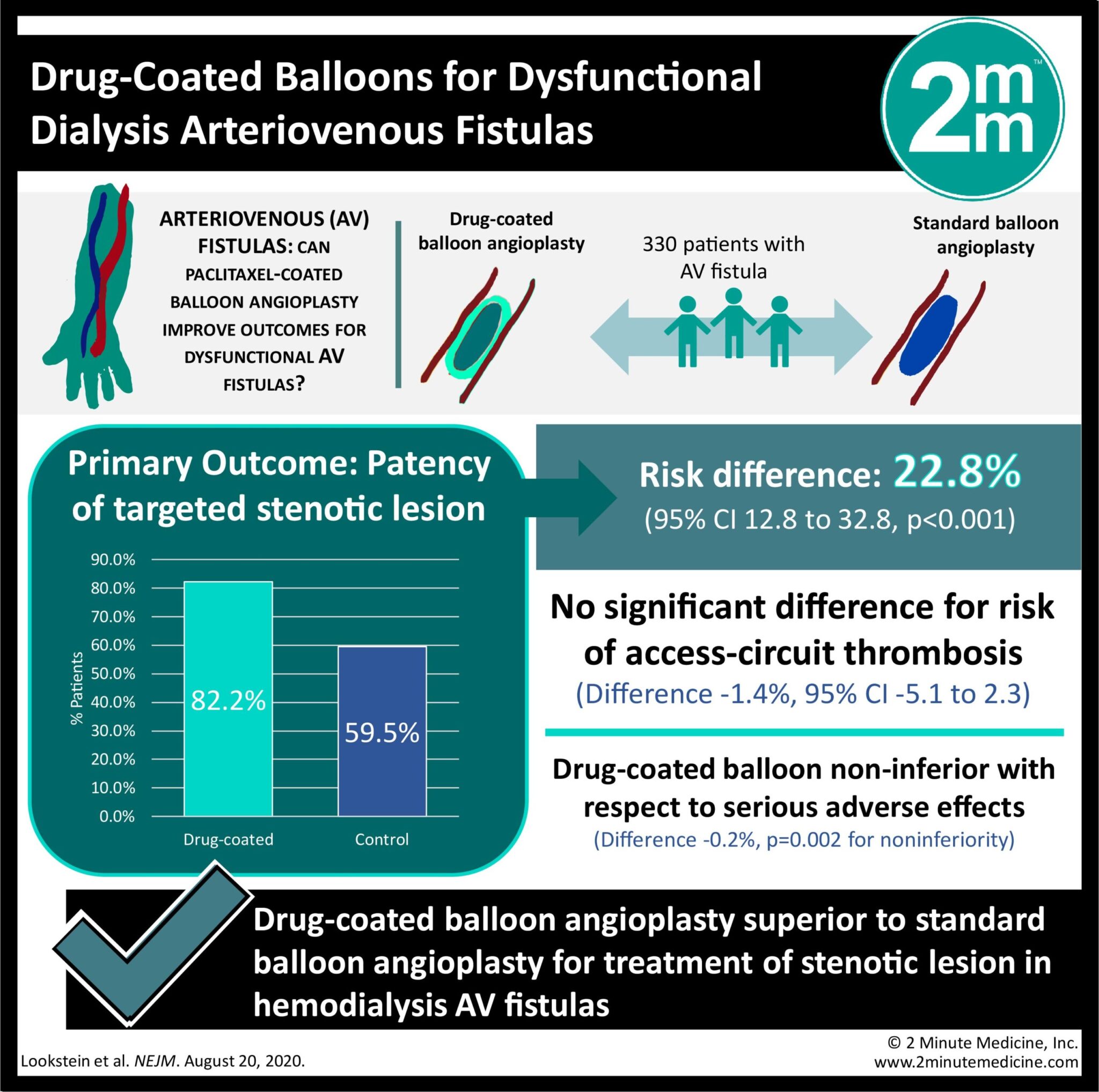 VisualAbstract Drugcoated balloon angioplasty for arteriovenous