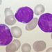 Dasatinib and blinatumomab treatment for acute lymphoblastic leukemia