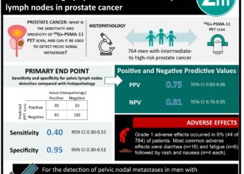 #VisualAbstract: Prostate-Specific Membrane Antigen Positron Emission Tomography can be used to detect pelvic lymph nodes in prostate cancer
