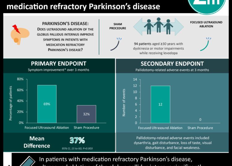 #VisualAbstract: Globus pallidus focused ultrasound ablation improved motor symptoms in patients with medication refractory Parkinson’s disease