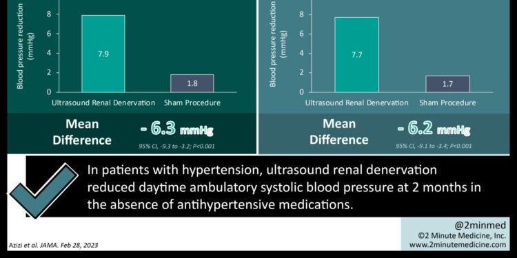#VisualAbstract: Ultrasound renal denervation lowered daytime ambulatory systolic blood pressure among patients with hypertension