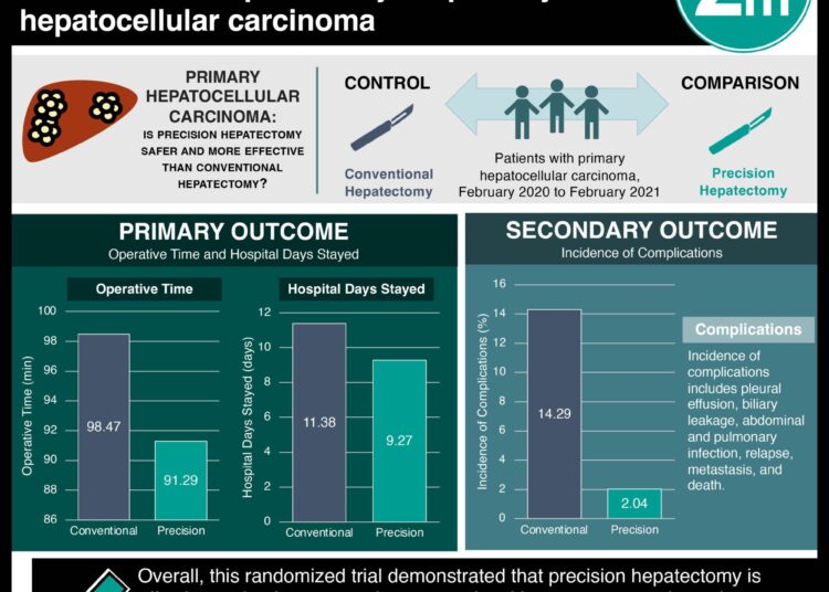 #VisualAbstract: Primary hepatectomy may be superior to conventional hepatectomy for primary hepatocellular carcinoma