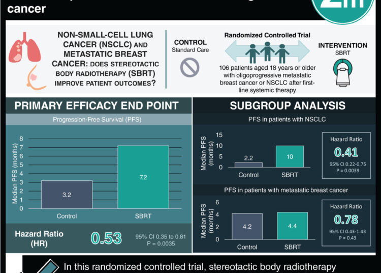#VisualAbstract: Stereotactic body radiotherapy enhances survival in patients with non-small cell lung cancer