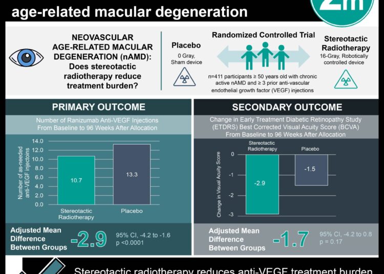 #VisualAbstract Stereotactic Radiotherapy Reduces Treatment Burden In Neovascular Age-Related Macular Degeneration
